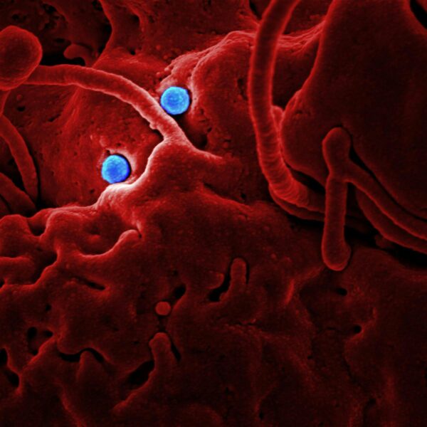 Detailed microscopic image showing red structures and blue virus particles.