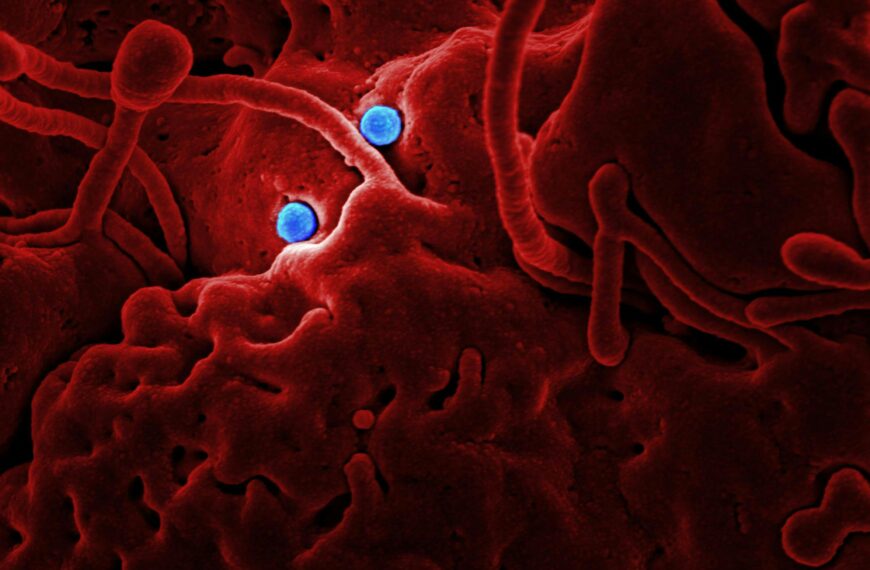 Detailed microscopic image showing red structures and blue virus particles.